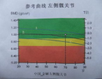 唑来膦酸多少钱一支,唑来膦酸是一种常用于治疗骨质疏松、恶性肿瘤骨转移等病症的药物